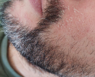 סבוריאה בפנים - תמונת פרופיל בזקן - אריק