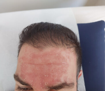 סבוריאה בפנים - אריק