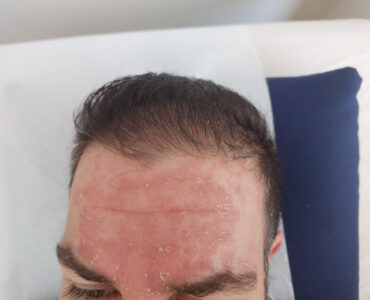 סבוריאה בפנים - אריק