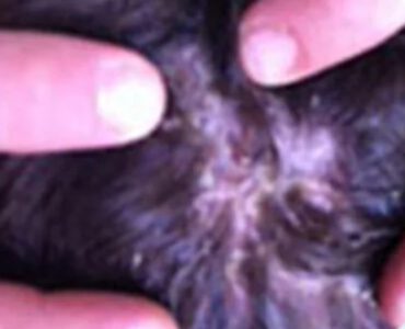 סבוריאה בקרקפת