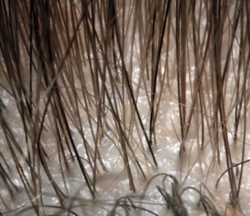 שורשי שיער מקרוב - דוד פרלה