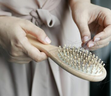 נשירת שיער פתאומית